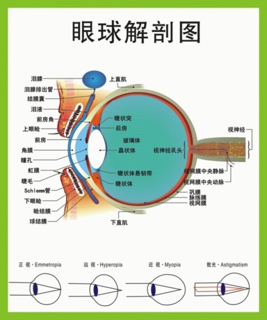 如何预防玻璃体出血